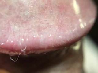 10x view of my penis