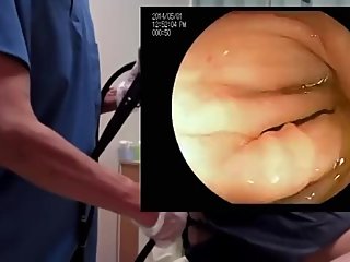 Japanese live colonoscopy